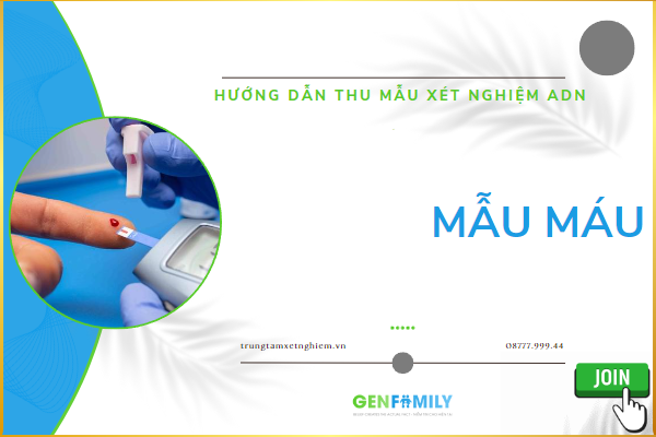 Xét nghiệm ADN bằng máu: Hướng dẫn, lưu ý và chi phí nên xem 1 Xét nghiệm ADN bằng máu