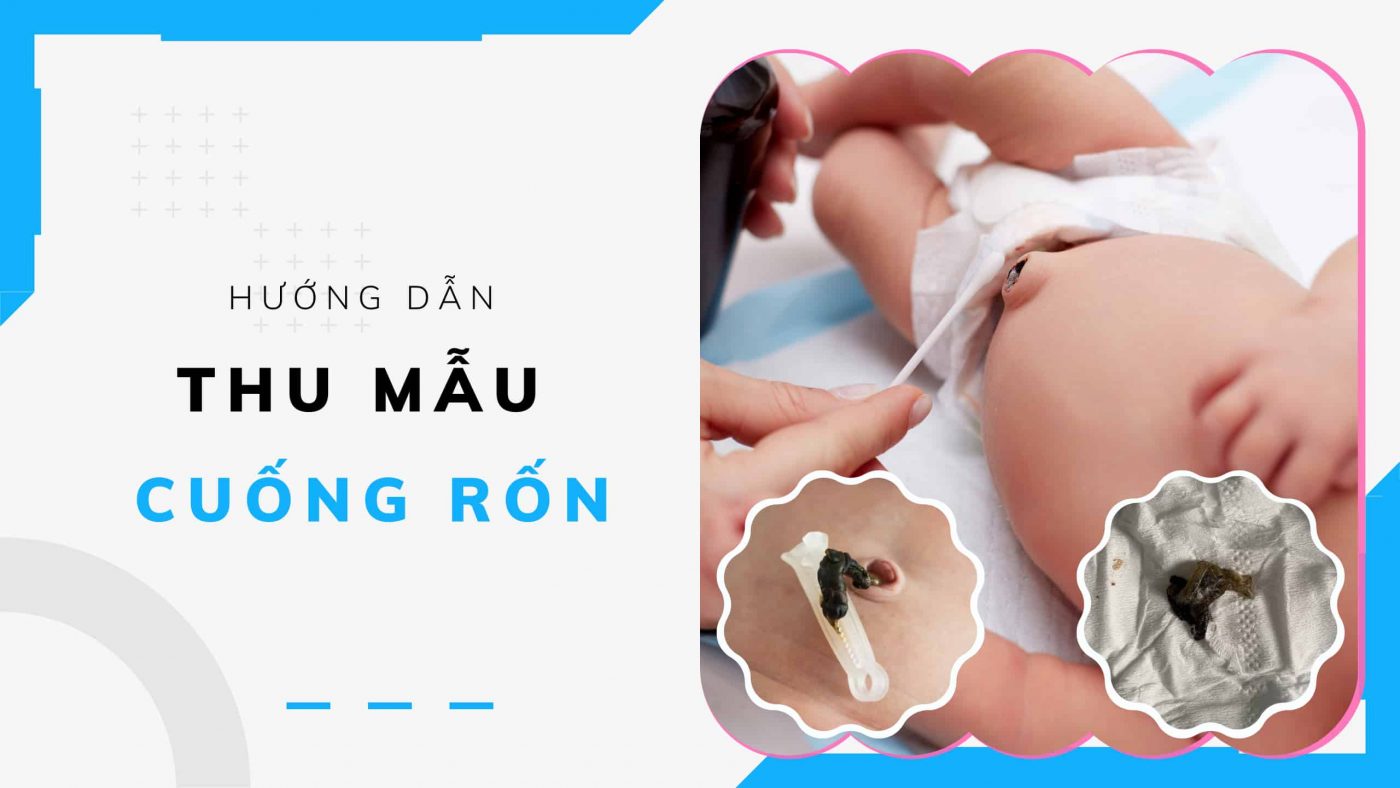 thu mẫu cuống rốn