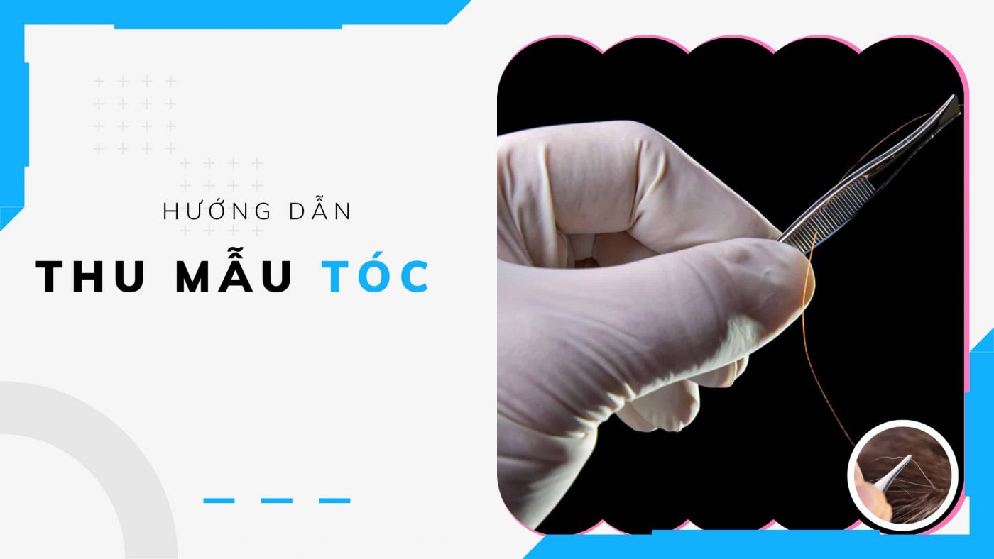 thu mẫu tóc