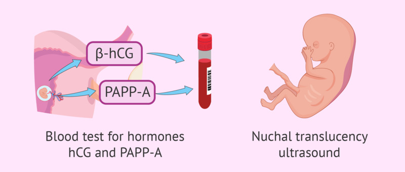 Mách nhỏ: Review xét nghiệm Double Test bao nhiêu tiền? 6 kiểm tra nồng độ β-hCG và PAPP-A